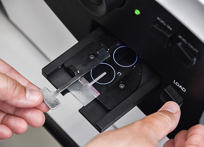 Sperm analyzer